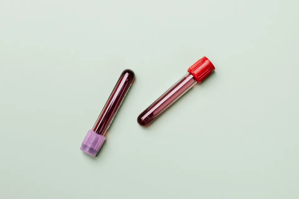 Two blood sample tubes (illustrative photo)